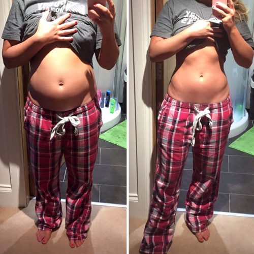 before-after-posture-instagram-body-photos-1-58c10954650b6__700