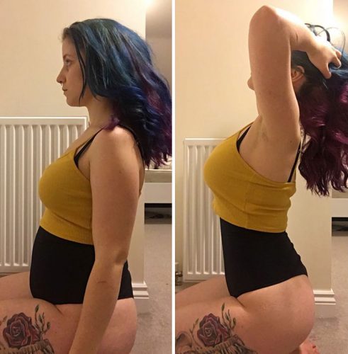 before-after-posture-instagram-body-photos-36