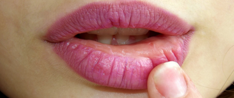 Door welke kleur lipstick lijken jouw tanden witter?
