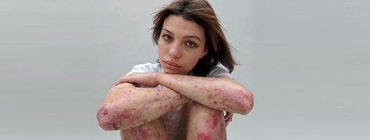 Vrouwen onthullen hun littekens met het verhaal erachter