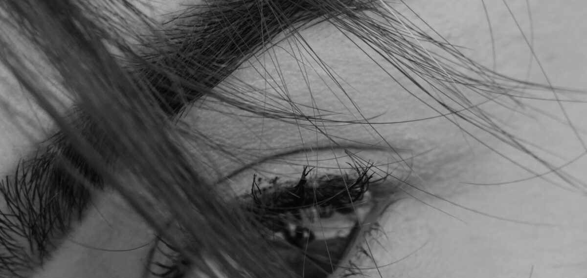 brow lift